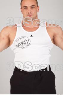 Singlet texture of Gene 0001